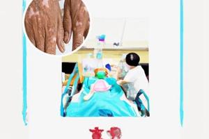兰州中研白淀疯医院在什么地方