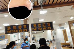 兰州中研医院看白斑佳评怎么样