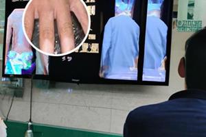 转移因子口服液多少钱