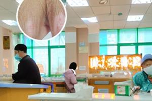兰州中研美国308激光