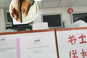 兰州中研白颠疯医院有治疗好的吗