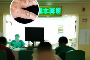兰州中研医院治疗白癜风的医生