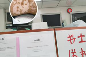 甘肃白斑病医院位置图最新