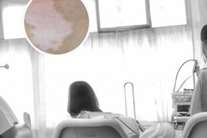 兰州中研白癜风医院论坛