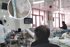 伍德灯检测图片