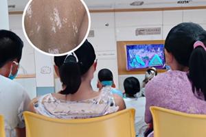 兰州白斑治疗研究中心