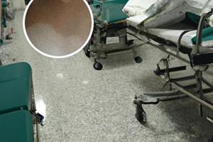 谁到过兰州中研白癜风医院去看过咋样