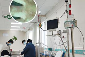 兰州中研白癜风医院在甘肃兰州哪里