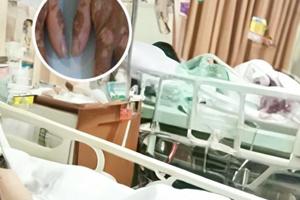兰州中研医院哪家好