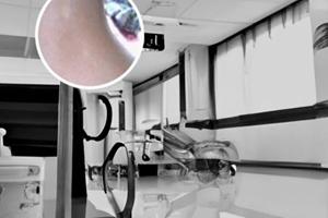 兰州中研白癜风医院治愈要多久
