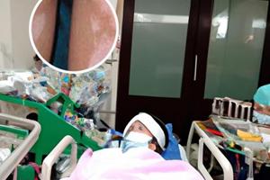 兰州中研白癜风医院治疗方法