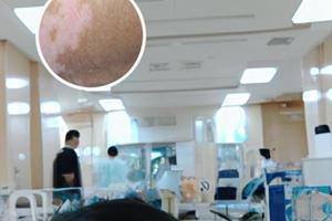 兰州中研白癜风医院专家坐诊时间