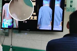 兰州中研医院专家简介介绍