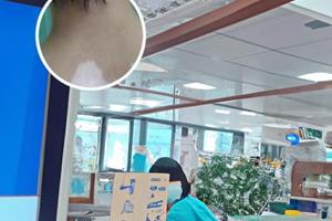 兰州中研白癜风手指白癜风怎么治