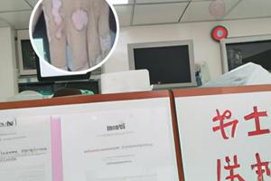 兰州中研医院靠谱么