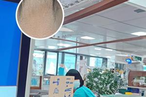 天水白癜风医院治疗费用