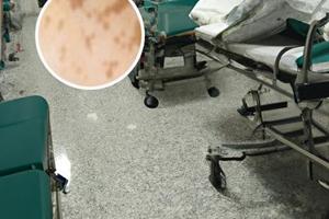 兰州中研皮肤病医院专家