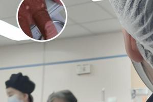 兰州中研白癜风医院治疗白癜风要多少钱