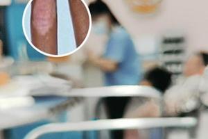 兰州中研白癜风医院公交线路