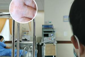 兰州中研白癜风医院手机官网