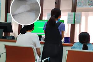 兰州治疗白癜风医院