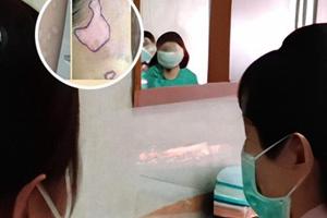 兰州中研白殿风医院怎么挂号