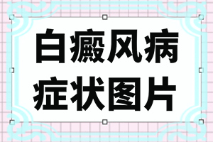 手心能看见白点点是怎么回事