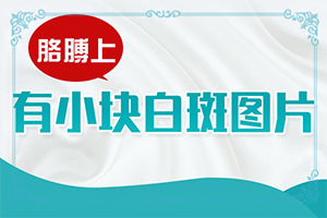 后天白点癫风能彻底治好吗