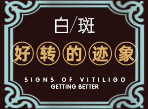 儿童白癞癜风怎么引起的呢吃什么药好得快点