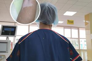 面部捈他克莫司可以和地丙醇交叉使用