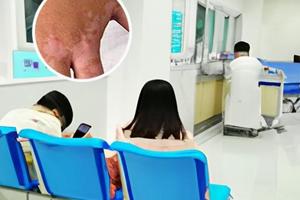 卤米松乳膏白斑耳朵可以用吗
