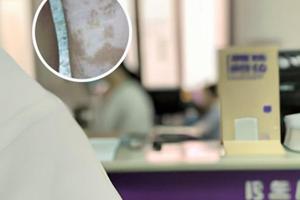 他克莫司浓度低了会怎么样