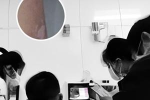 胸腺五肽针看白斑怎么打