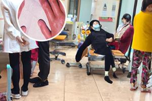 卤米松乳膏白斑又变大了