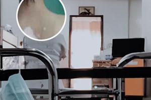 他克莫司买什么牌子