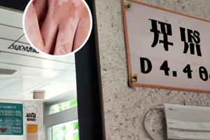 卤米松三氯生乳膏抹白斑没有效果怎么回事