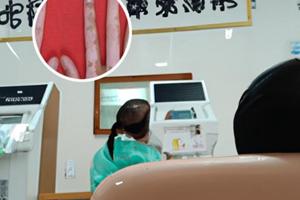 他克莫司治白斑多久治愈正常