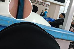 早克他克莫司为什么这么便宜