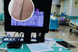 胸腺五肽可以外用吗