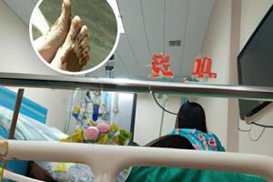 盐酸多西环素片是治疗什么病