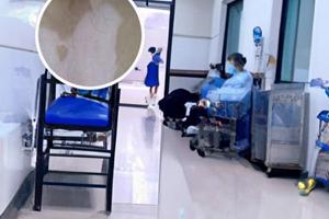 他克莫司软膏能连续用多长时间