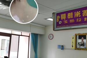 他克莫司软膏0.1浓度高吗