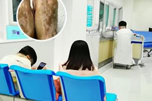 得宝松第几天作用最强