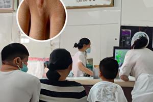 醋酸泼尼松又叫啥