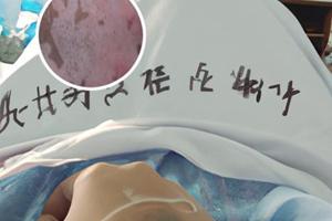 他克莫司软膏含激素吗脸上能不能