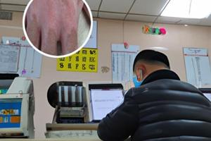 艾洛松治疗什么病