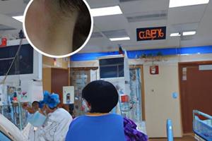 复方醋酸地塞米松乳膏去什么