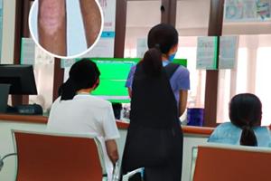 卤米松乳膏白点能用吗