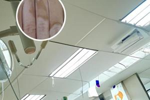 01他克莫司软膏