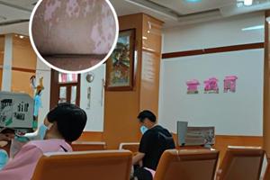 白芍总苷胶囊效果怎么样